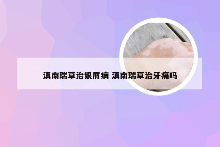 滇南瑞草治银屑病 滇南瑞草治牙痛吗