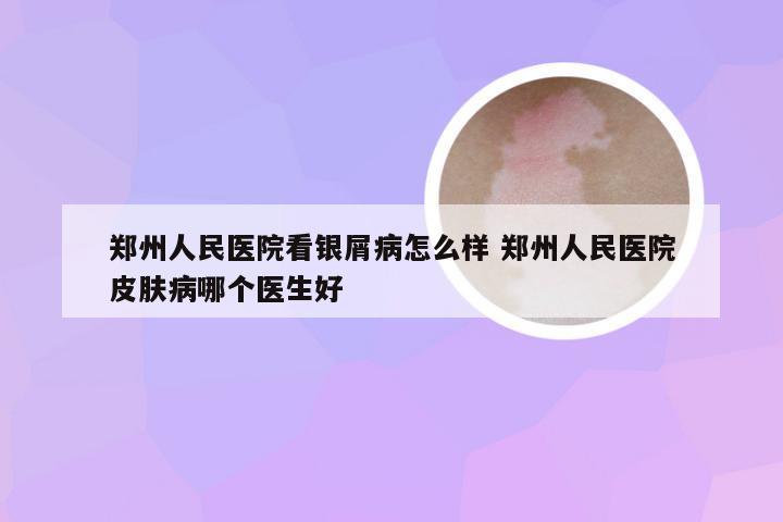 郑州人民医院看银屑病怎么样 郑州人民医院皮肤病哪个医生好