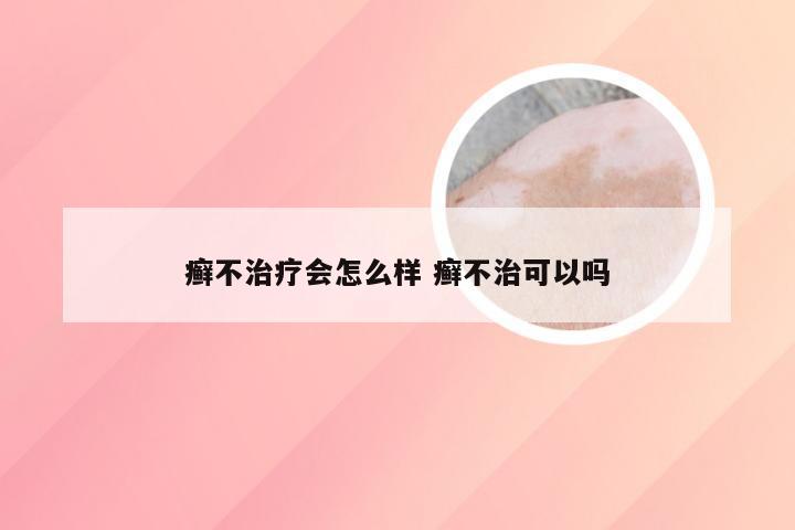 癣不治疗会怎么样 癣不治可以吗