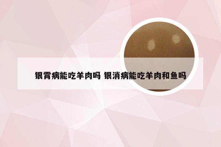银霄病能吃羊肉吗 银消病能吃羊肉和鱼吗