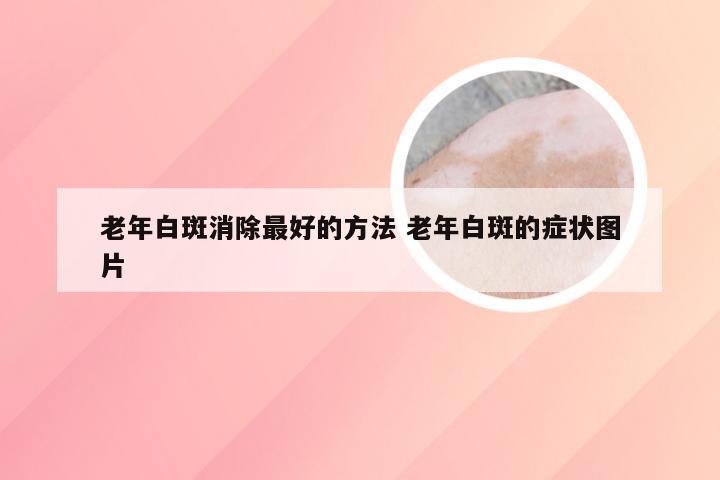 老年白斑消除最好的方法 老年白斑的症状图片