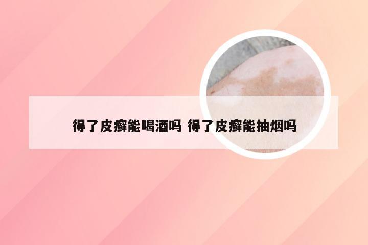 得了皮癣能喝酒吗 得了皮癣能抽烟吗