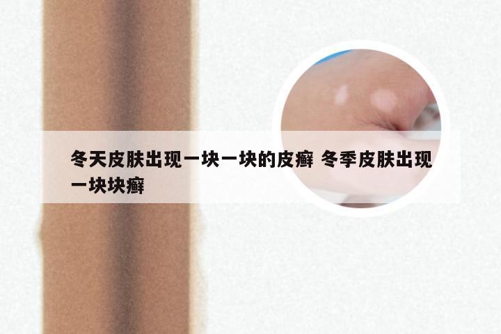 冬天皮肤出现一块一块的皮癣 冬季皮肤出现一块块癣