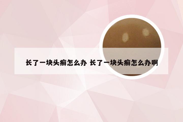 长了一块头癣怎么办 长了一块头癣怎么办啊