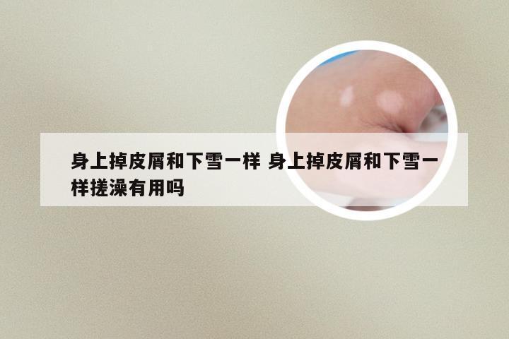 身上掉皮屑和下雪一样 身上掉皮屑和下雪一样搓澡有用吗