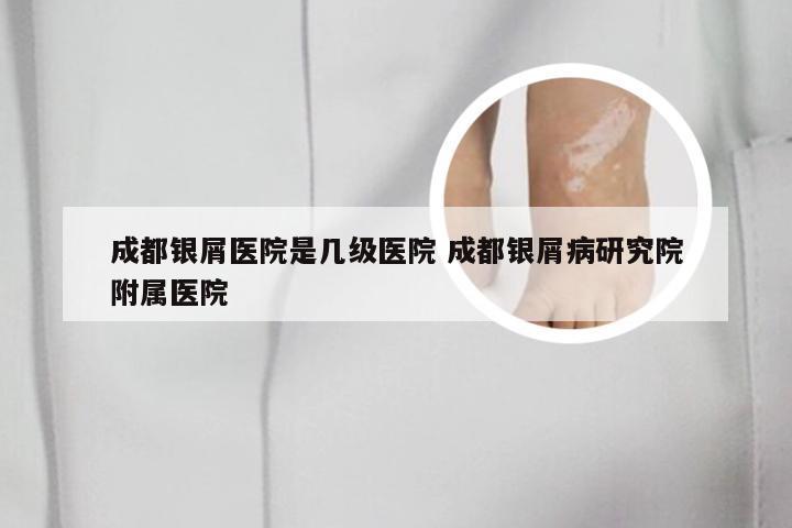 成都银屑医院是几级医院 成都银屑病研究院附属医院