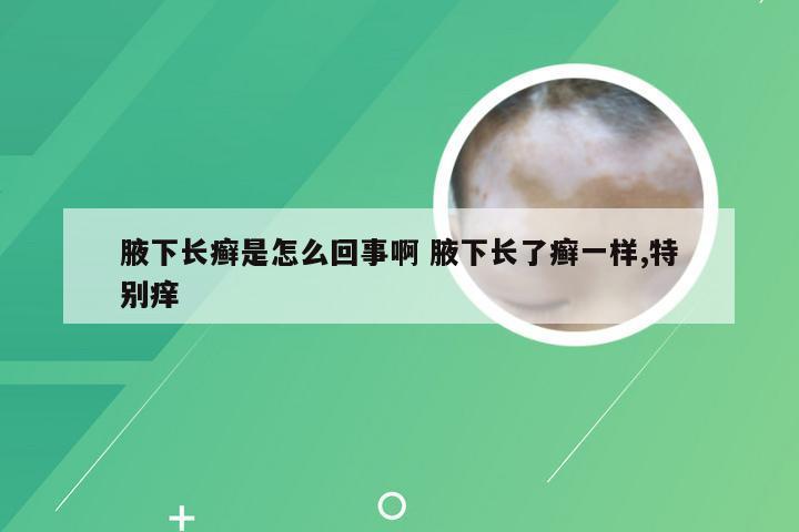 腋下长癣是怎么回事啊 腋下长了癣一样,特别痒