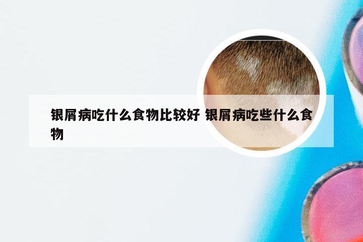 银屑病吃什么食物比较好 银屑病吃些什么食物