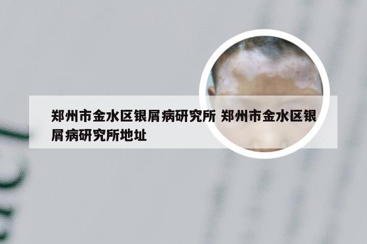 郑州市金水区银屑病研究所 郑州市金水区银屑病研究所地址