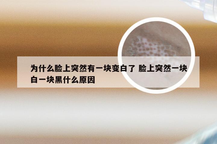 为什么脸上突然有一块变白了 脸上突然一块白一块黑什么原因