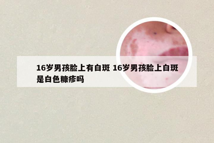 16岁男孩脸上有白斑 16岁男孩脸上白斑是白色糠疹吗