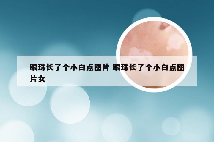 眼珠长了个小白点图片 眼珠长了个小白点图片女