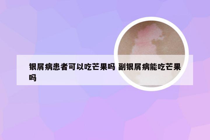 银屑病患者可以吃芒果吗 副银屑病能吃芒果吗
