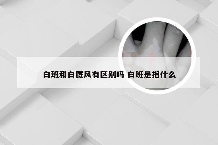 白班和白厩风有区别吗 白班是指什么