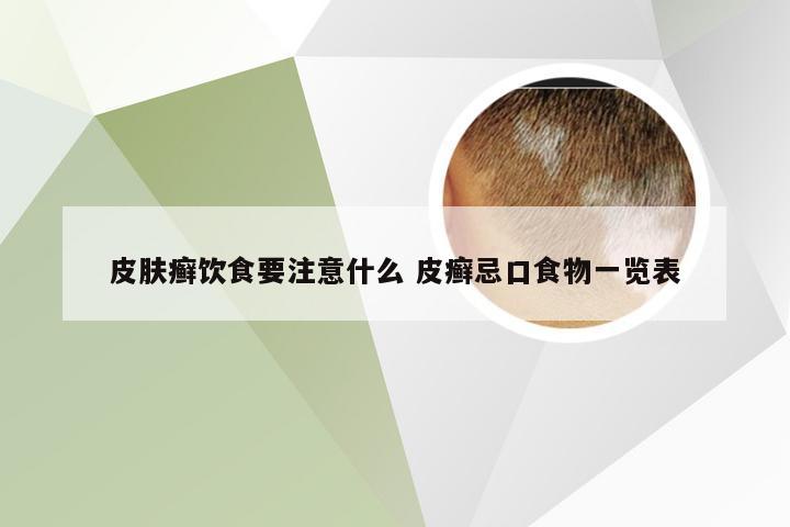 皮肤癣饮食要注意什么 皮癣忌口食物一览表