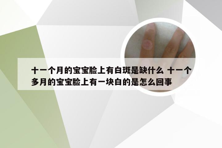 十一个月的宝宝脸上有白斑是缺什么 十一个多月的宝宝脸上有一块白的是怎么回事