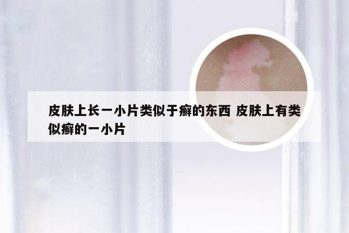 皮肤上长一小片类似于癣的东西 皮肤上有类似癣的一小片