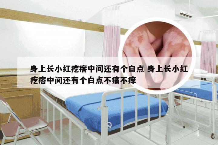 身上长小红疙瘩中间还有个白点 身上长小红疙瘩中间还有个白点不痛不痒