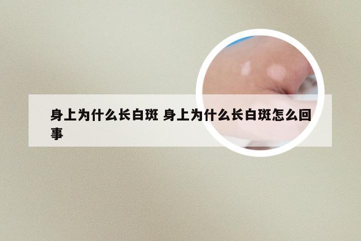 身上为什么长白斑 身上为什么长白斑怎么回事