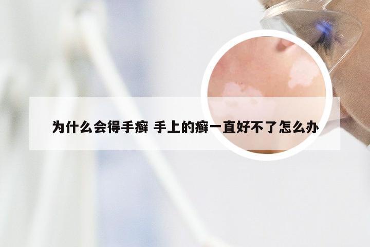 为什么会得手癣 手上的癣一直好不了怎么办
