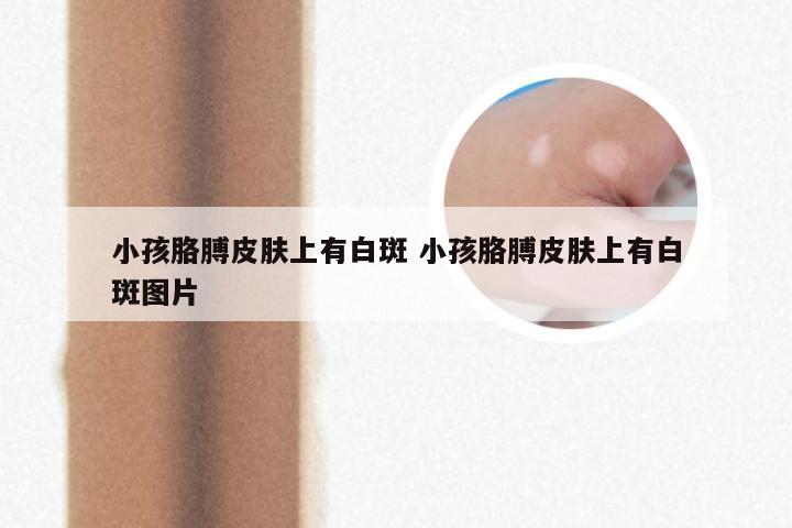小孩胳膊皮肤上有白斑 小孩胳膊皮肤上有白斑图片