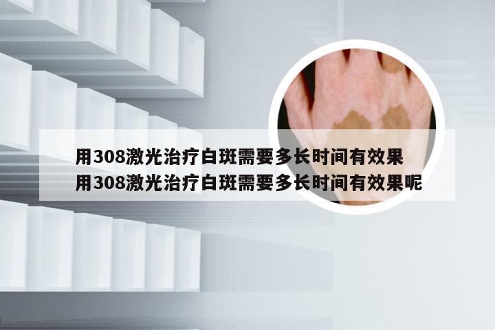 用308激光治疗白斑需要多长时间有效果 用308激光治疗白斑需要多长时间有效果呢