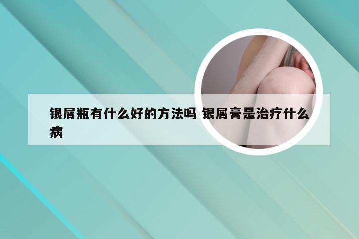 银屑瓶有什么好的方法吗 银屑膏是治疗什么病