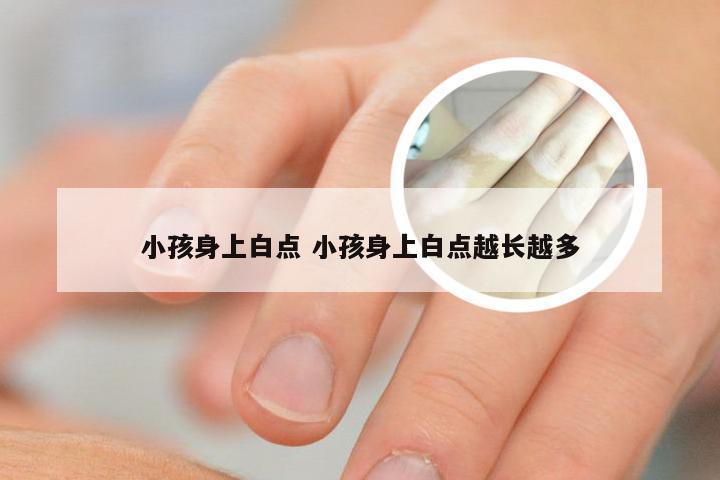 小孩身上白点 小孩身上白点越长越多