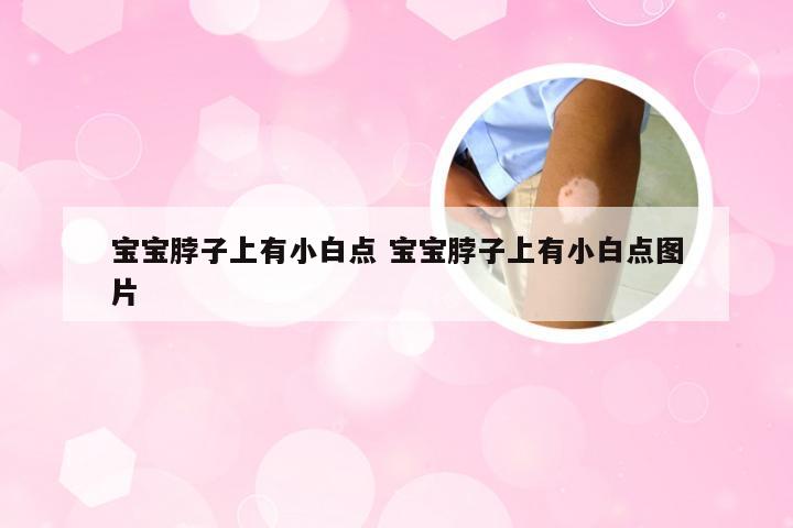 宝宝脖子上有小白点 宝宝脖子上有小白点图片