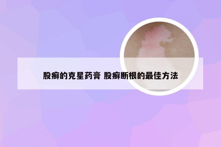 股癣的克星药膏 股癣断根的最佳方法