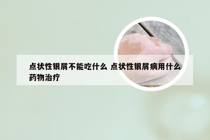点状性银屑不能吃什么 点状性银屑病用什么药物治疗