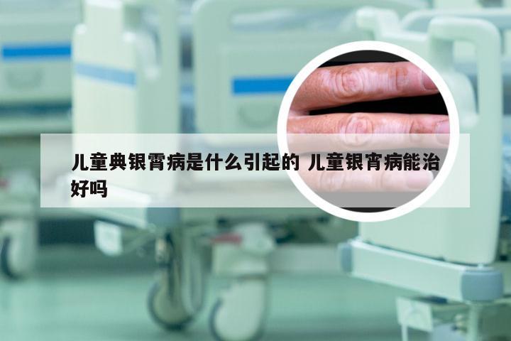 儿童典银霄病是什么引起的 儿童银宵病能治好吗
