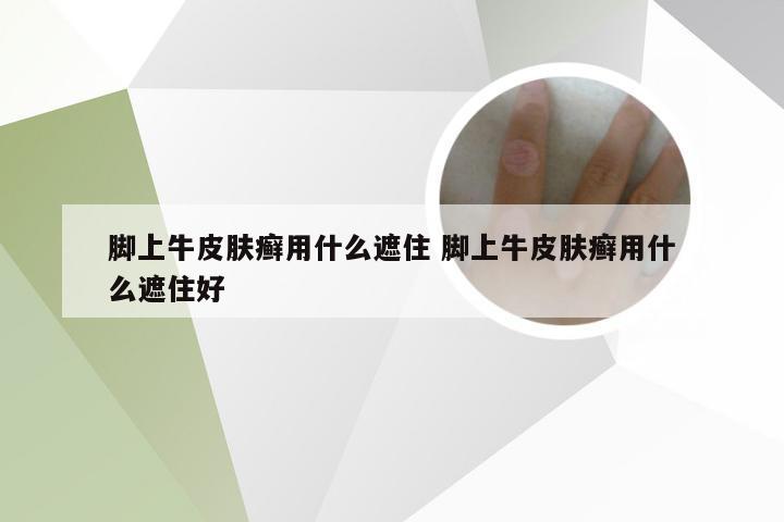 脚上牛皮肤癣用什么遮住 脚上牛皮肤癣用什么遮住好