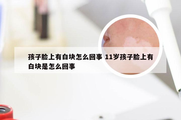 孩子脸上有白块怎么回事 11岁孩子脸上有白块是怎么回事