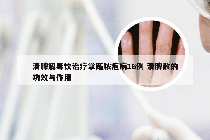 清脾解毒饮治疗掌跖脓疱病16例 清脾散的功效与作用