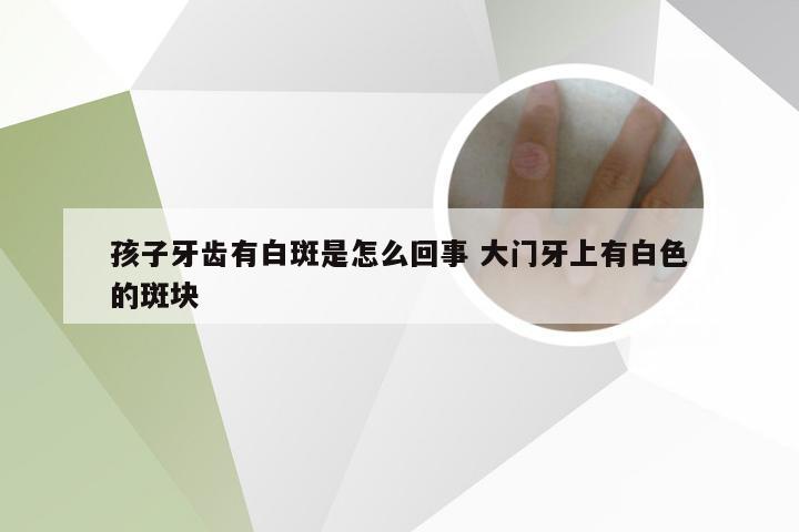 孩子牙齿有白斑是怎么回事 大门牙上有白色的斑块