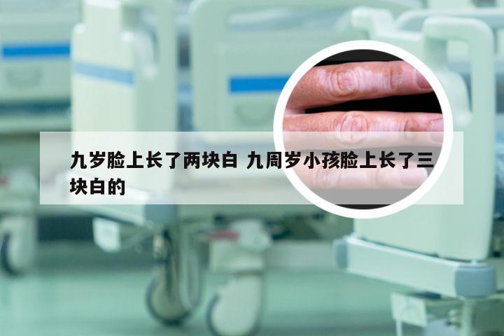 九岁脸上长了两块白 九周岁小孩脸上长了三块白的