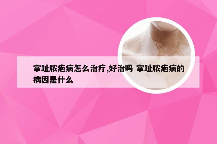 掌趾脓疱病怎么治疗,好治吗 掌趾脓疱病的病因是什么