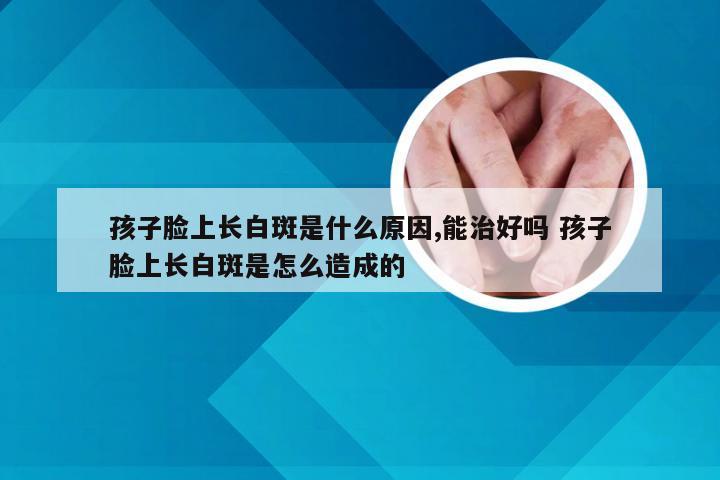 孩子脸上长白斑是什么原因,能治好吗 孩子脸上长白斑是怎么造成的