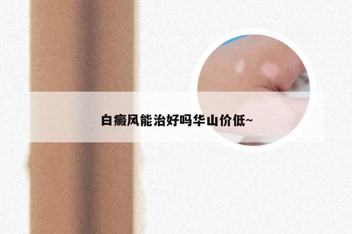 白癜风能治好吗华山价低~