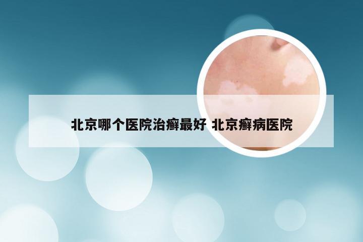 北京哪个医院治癣最好 北京癣病医院