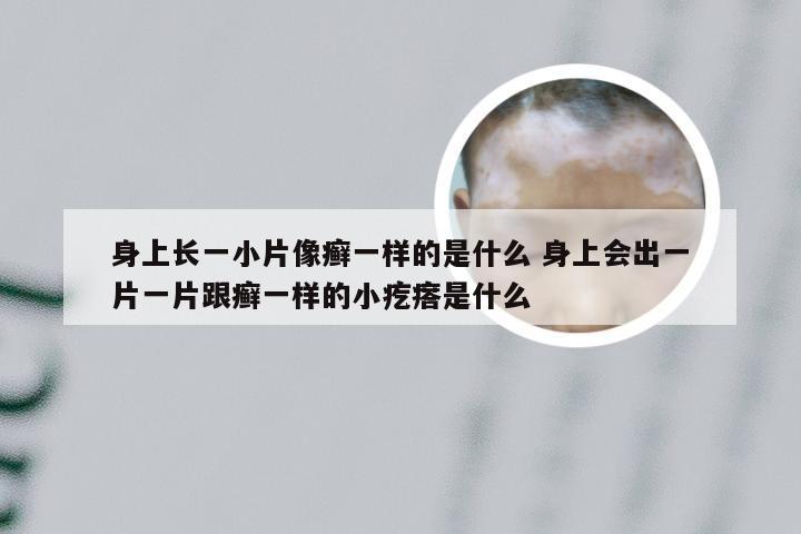 身上长一小片像癣一样的是什么 身上会出一片一片跟癣一样的小疙瘩是什么