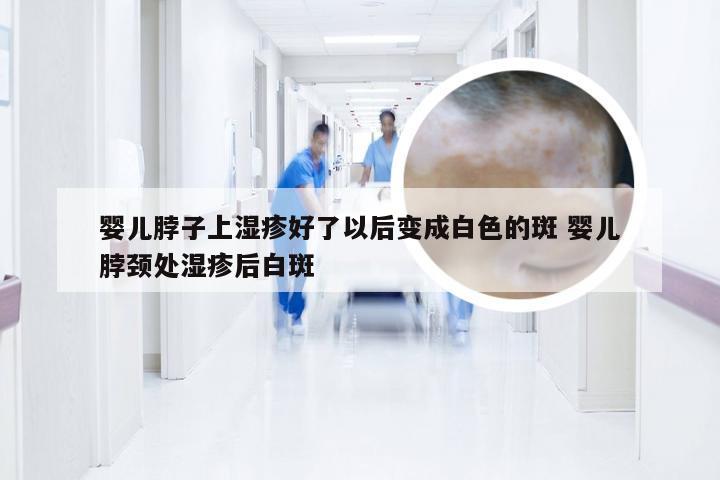 婴儿脖子上湿疹好了以后变成白色的斑 婴儿脖颈处湿疹后白斑