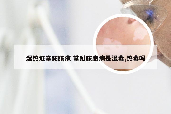 湿热证掌跖脓疱 掌趾脓胞病是湿毒,热毒吗