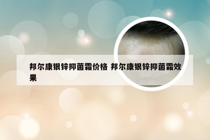 邦尔康银锌抑菌霜价格 邦尔康银锌抑菌霜效果