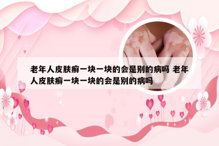 老年人皮肤癣一块一块的会是别的病吗 老年人皮肤癣一块一块的会是别的病吗