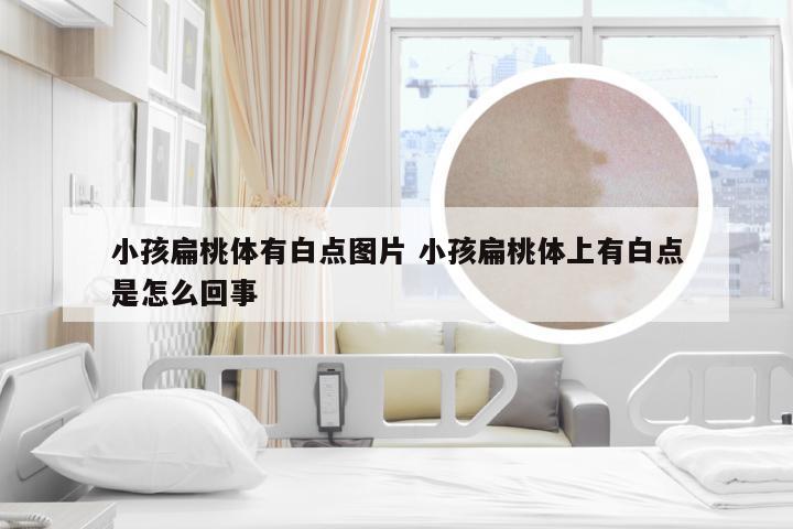 小孩扁桃体有白点图片 小孩扁桃体上有白点是怎么回事