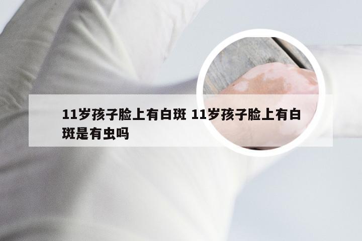 11岁孩子脸上有白斑 11岁孩子脸上有白斑是有虫吗