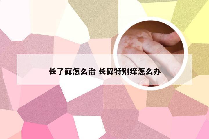 长了藓怎么治 长藓特别痒怎么办