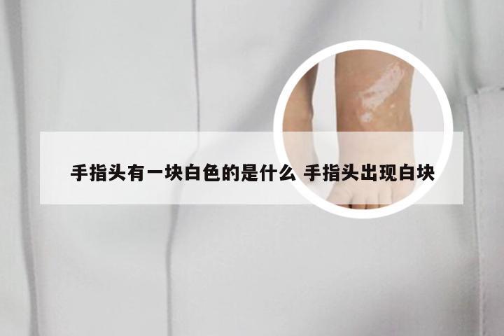 手指头有一块白色的是什么 手指头出现白块